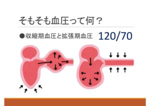 血圧5のサムネイル