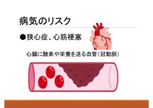 血圧9のサムネイル